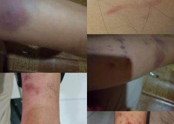 Jeritan Untuk Presiden, Warga Bassiang Dipenjara Setelah Dikeroyok Akibat Kesalahan SOP Visum PKM Ponsel