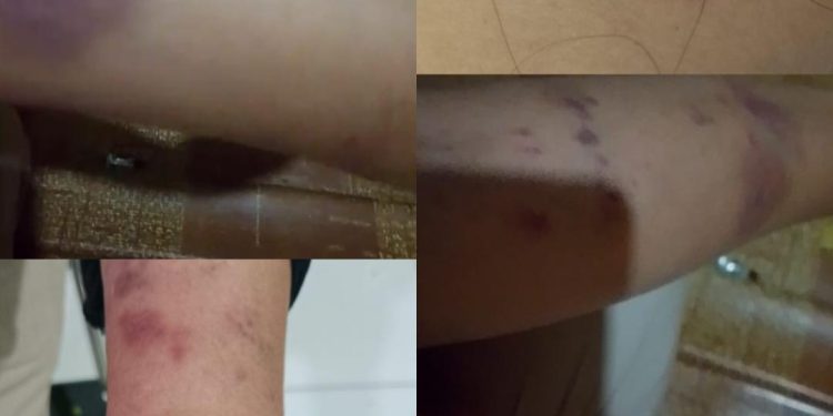 Jeritan Untuk Presiden, Warga Bassiang Dipenjara Setelah Dikeroyok Akibat Kesalahan SOP Visum PKM Ponsel